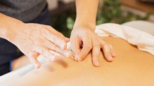 A acupuncturist carefully places a needle in the back of a patient.